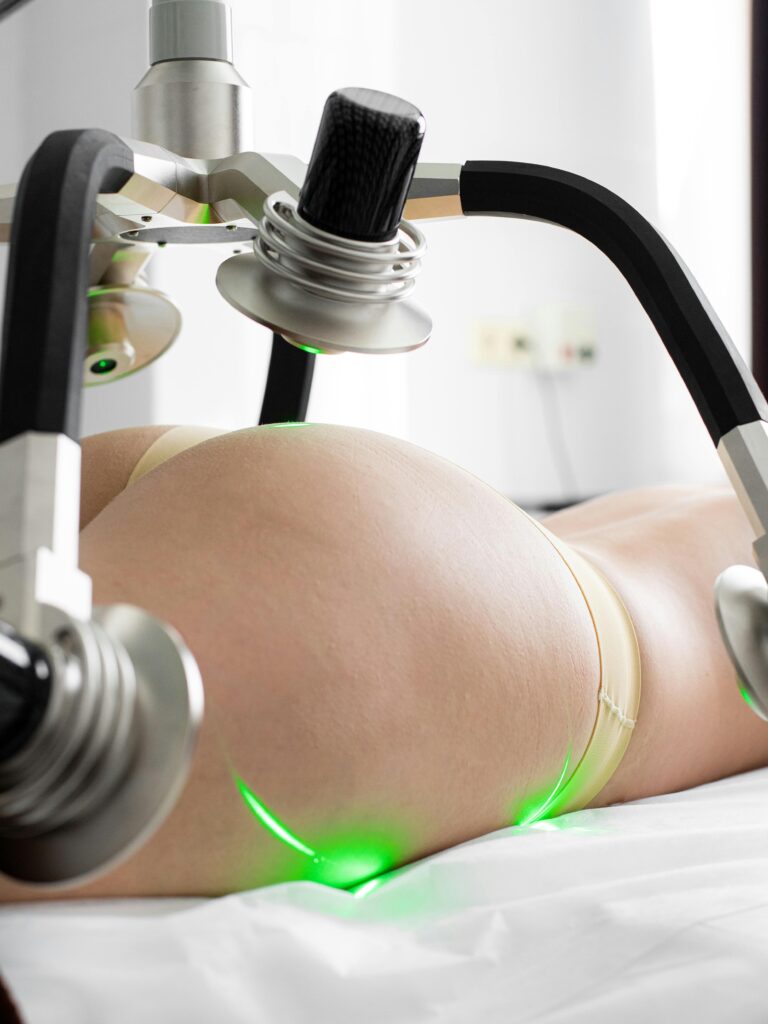 pexels photo 7772686 7772686 Crop unrecognizable female doing non invasive laser body shaping treatment in modern clinic